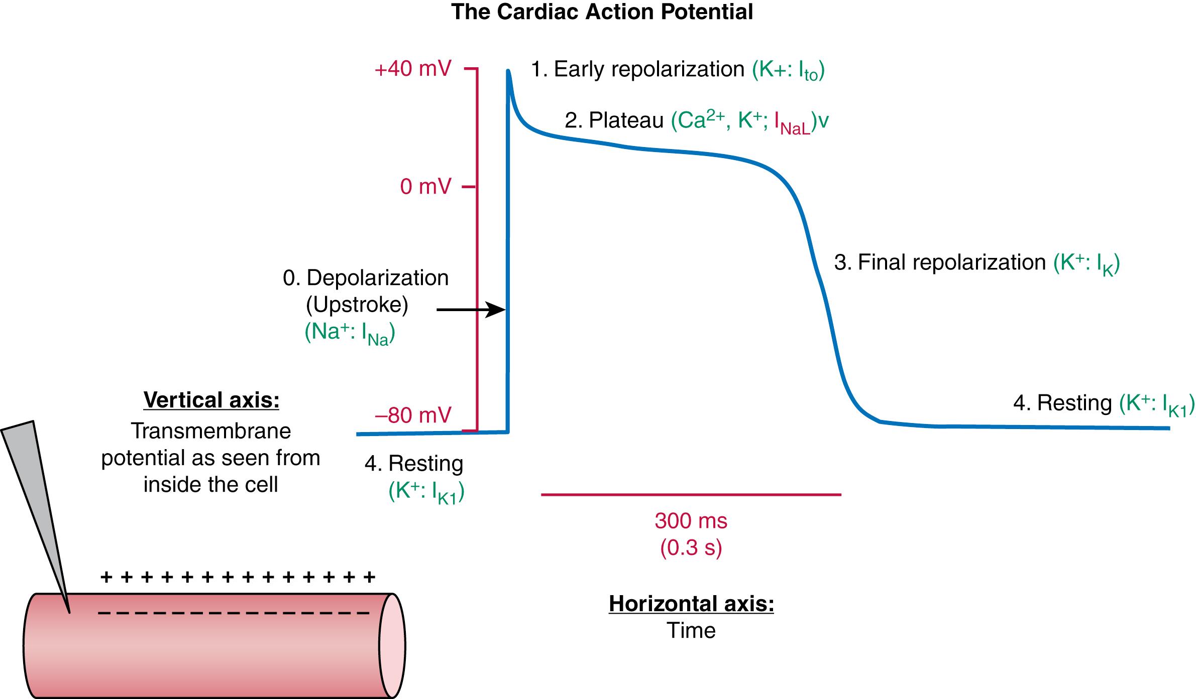 FIGURE 62.2, A representative ventricular action potential, with phases numbered 0 to 4. The major ionic currents active during each phase are shown in green type. The late Na current I NaL is augmented in some forms of heritable and acquired heart disease. The drawing at lower left of the figure depicts cardiac muscle impaled with an electrode. The resting membrane potential of the inside of the cell is negative with respect to the outside.