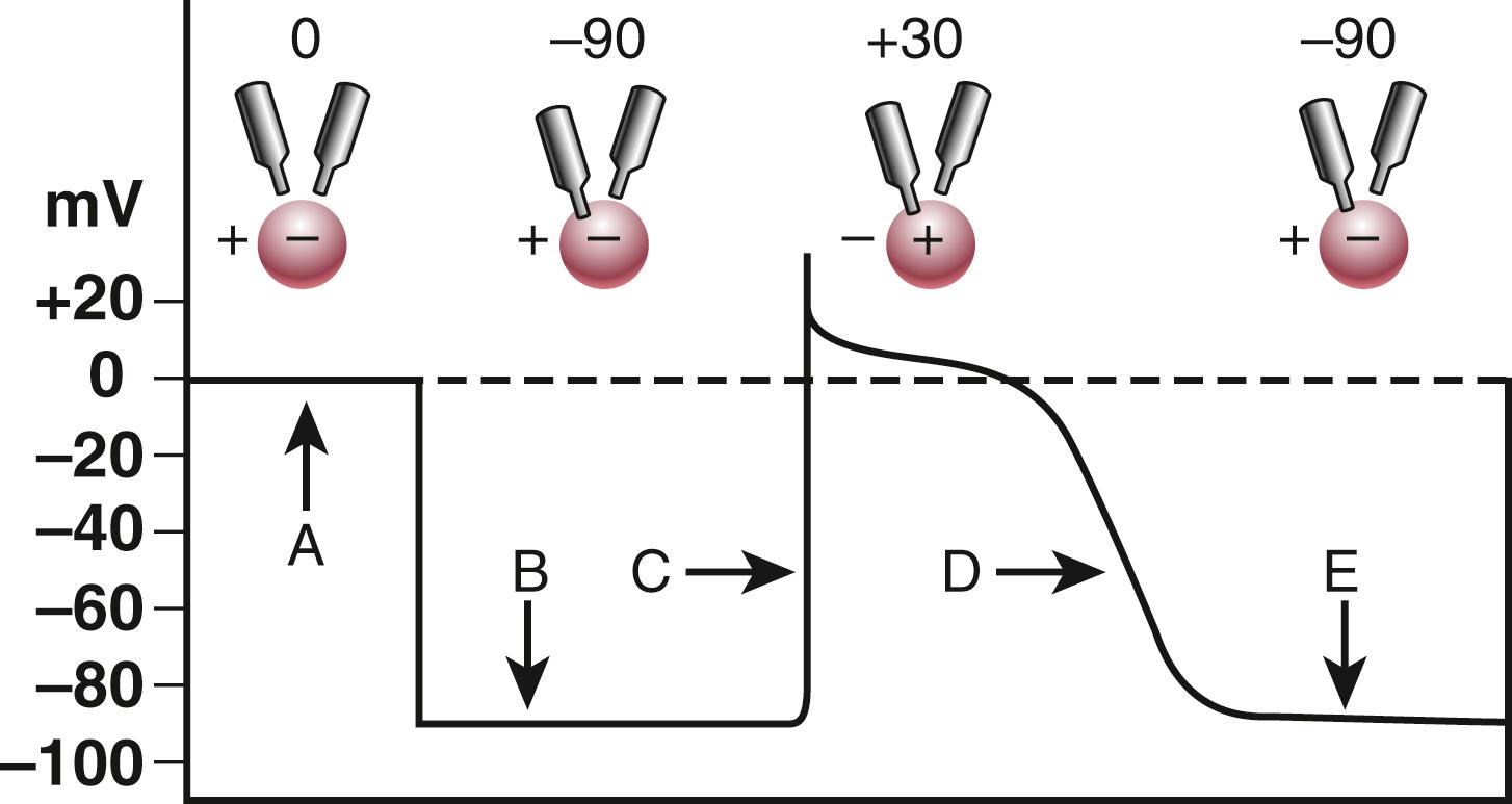 EFIGURE 62.1, Demonstration of action potentials recorded during impalement of a cardiac cell. Upper row, Shown are a cell (circle) , two microelectrodes, and stages during impalement of the cell and its activation and recovery. Both microelectrodes are extracellular (A) , and no difference in potential exists between them (0 potential). The environment inside the cell is negative, and the outside is positive, because the cell is polarized. One microelectrode has pierced the cell membrane (B) to record the intracellular resting membrane potential, which is −90 mV with respect to the outside of the cell. The cell has depolarized (C) , and the upstroke of the action potential is recorded. At its peak voltage, the inside of the cell is approximately +30 mV with respect to the outside of the cell. The repolarization phase (D) is shown, with the membrane returning to its former resting potential (E) .