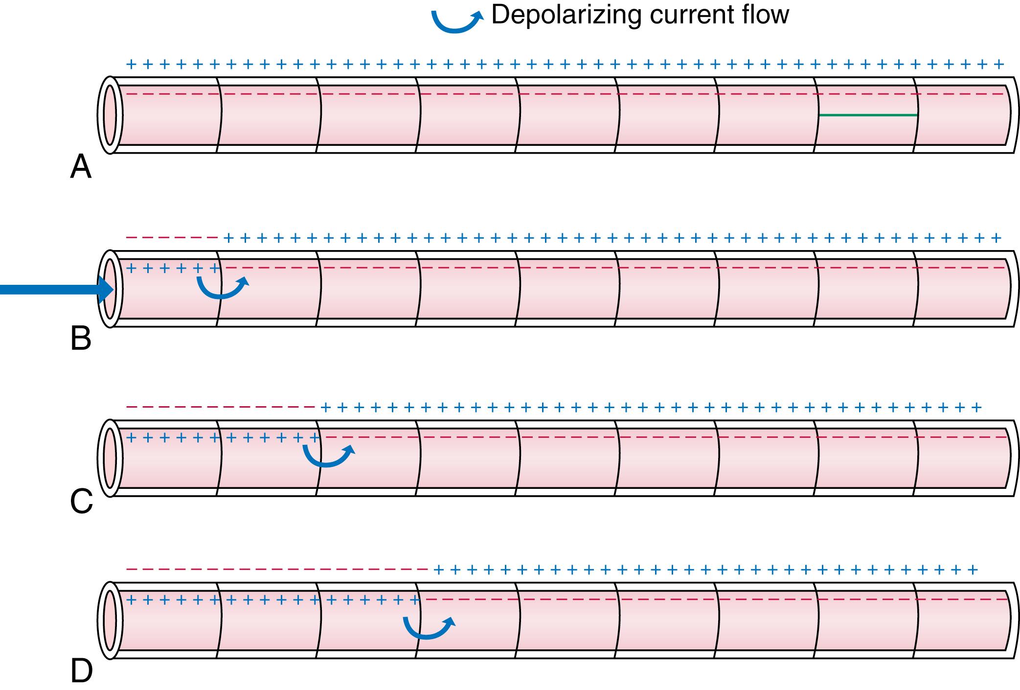 FIGURE 62.7, Schematic of an electrical impulse traversing a cardiac fiber bundle. The bundle is comprised of electrically coupled cardiomyocytes simulating a continuous cable. A , A resting bundle, with a negative (inside) transmembrane potential. B , Activation of the bundle from the left; the first cardiomyocyte in the bundle is depolarized, initiating an action potential and cell-to-cell current flow (curved arrow) and causing progressive depolarization of cells in the fiber ( C and D ).