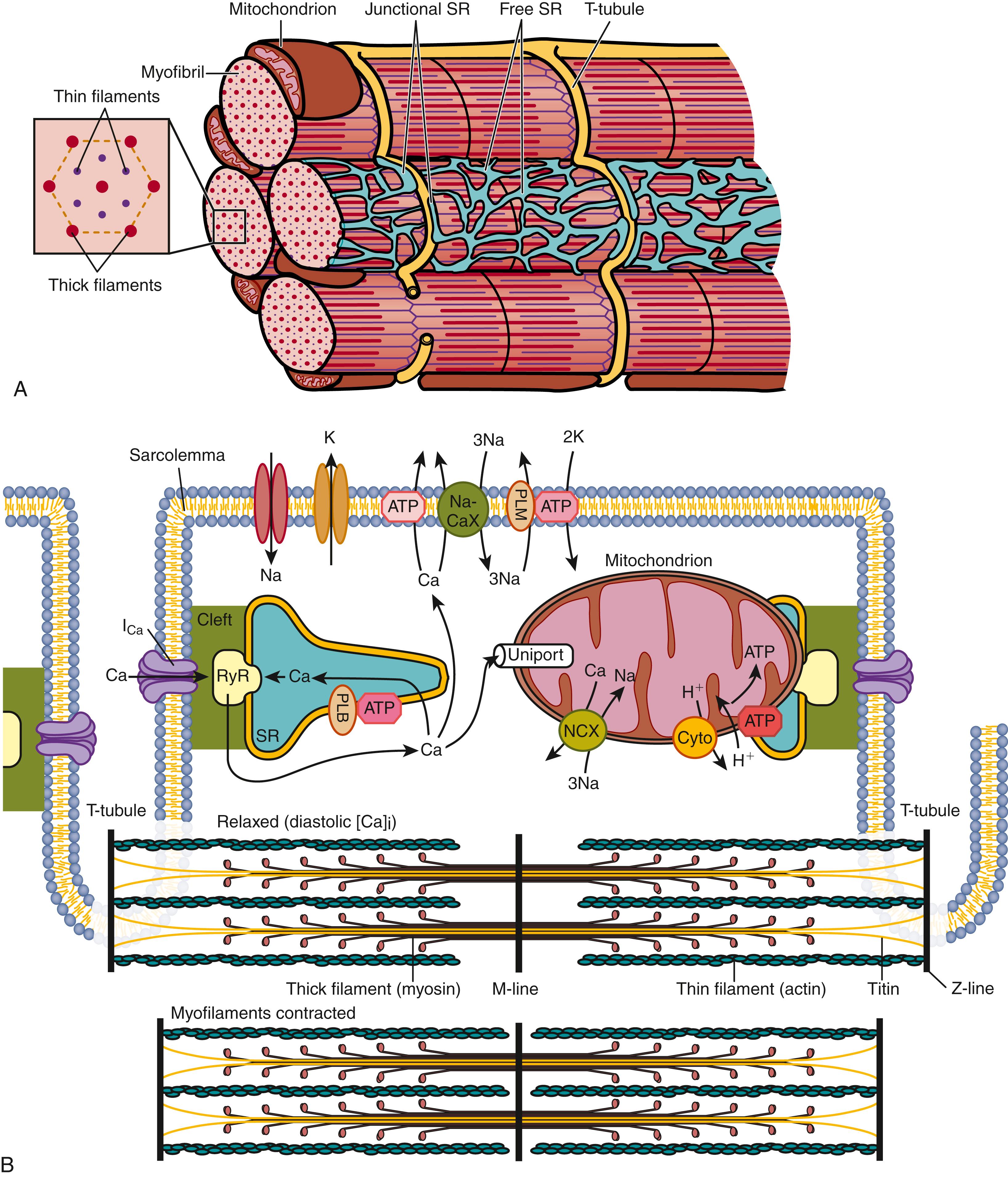 FIGURE 46.1, Ultrastructural components of excitation-contraction coupling in ventricular myocytes, viewed anatomically ( A, with inset showing an end-on view of thick and thin filament organization) and schematically (B). The action potential is conducted along the surface sarcolemma and sarcolemma that extends into the T tubules. Ca 2+ current (I Ca ) at sites of junctional SR clefts trigger local Ca 2+ release, and the Ca 2+ diffuses throughout the cytosol to activate myofilament contraction. The [Ca 2+ ] i quickly declines at each beat because of Ca 2+ uptake via the SR Ca 2+ -ATPase (ATP/PLB), extrusion via sarcolemmal Na + /Ca 2+ exchange (NCX) and Ca 2+ -ATPase (and mitochondrial Ca 2+ uniport), allowing relaxation (diastole) to proceed. The myofibrils are bundles of contractile proteins that are organized into a regular sarcomeric array, bounded longitudinally by Z-lines that are immediately adjacent to T tubules that run in parallel. In diastole ( bottom ) the thin filaments (containing mainly actin) create a cage around the thick filaments (containing mainly myosin) that have cross-bridges (myosin heads) that extend toward the thin filament. Myosin molecule tails all face the center of the sarcomere, creating a zone around the M-line devoid of myosin heads. During systole, the myosin cross-bridges pull the thin filament “cage” toward the M-line, thus shortening the sarcomere length (additional details are in subsequent figures). ATP , Adenosine triphosphate; PLB , phospholamban; SR , sarcoplasmic reticulum; T tubules , transverse tubules.