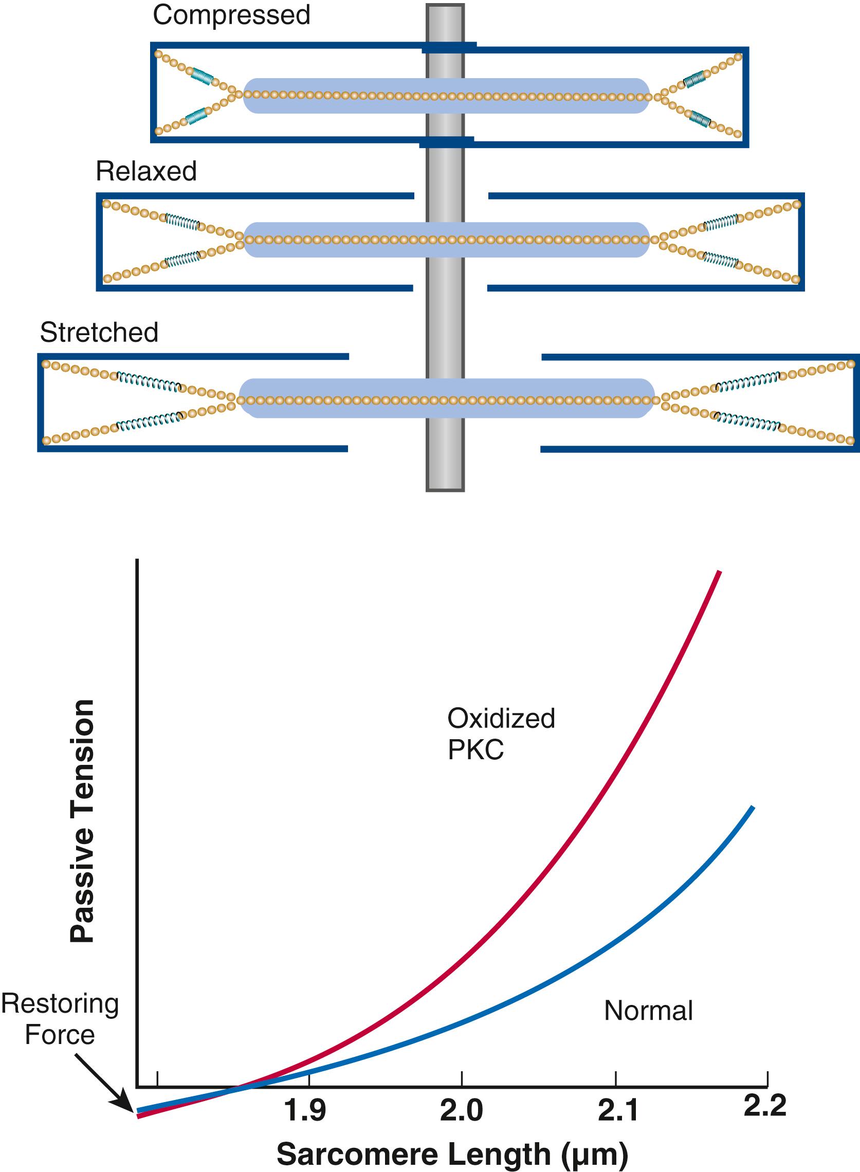 FIGURE 46.5, Titin is a huge elastic elongated protein that connects myosin and the M-line to the Z-line. It is a bidirectional spring that develops passive force in stretched sarcomeres and resting force in shortened sarcomeres. Upper panel, As the sarcomere is stretched to its maximum physiologic diastolic length of 2.2 μm, titin stretches and increases passive force generated (contributing to end-diastolic pressure). At short lengths ( top ), which may reflect end-systole, substantial restoring force is generated, shown as negative tension (lower panel). Note that oxidation and PKC-dependent phosphorylation increase titin stiffness.