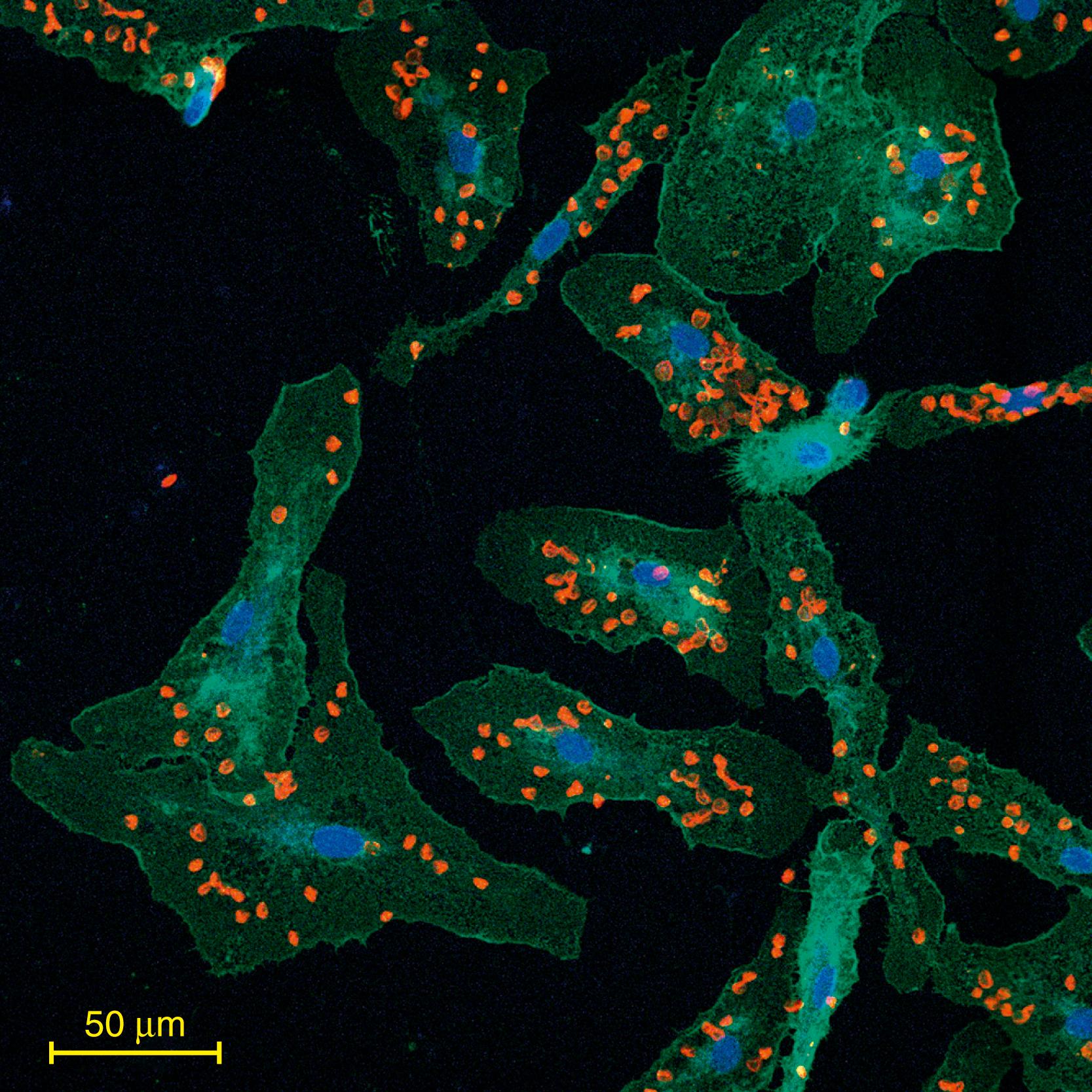 Fig. 8.2, Primary rat microglia in culture were exposed to red blood cells (RBC; red stain) harvested from rat tail vein. The confocal image shows presence of engulfed RBCs (red) within microglial cells (visualized with Iba1; green ), demonstrating microglia’s ability to phagocytose RBCs, which could play an important role in hematoma clearance.