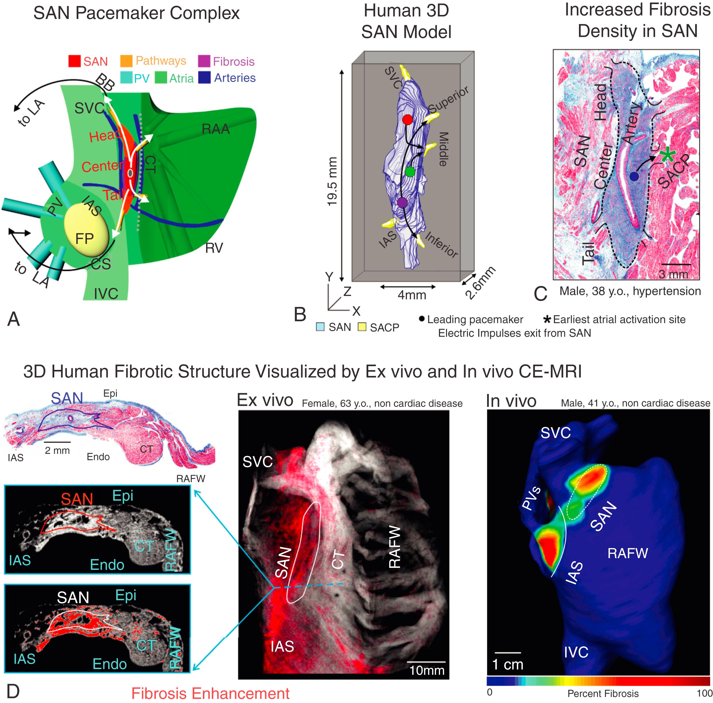 Fig. 28.1, The three-dimensional (3D) structure of the human SAN pacemaker complex.