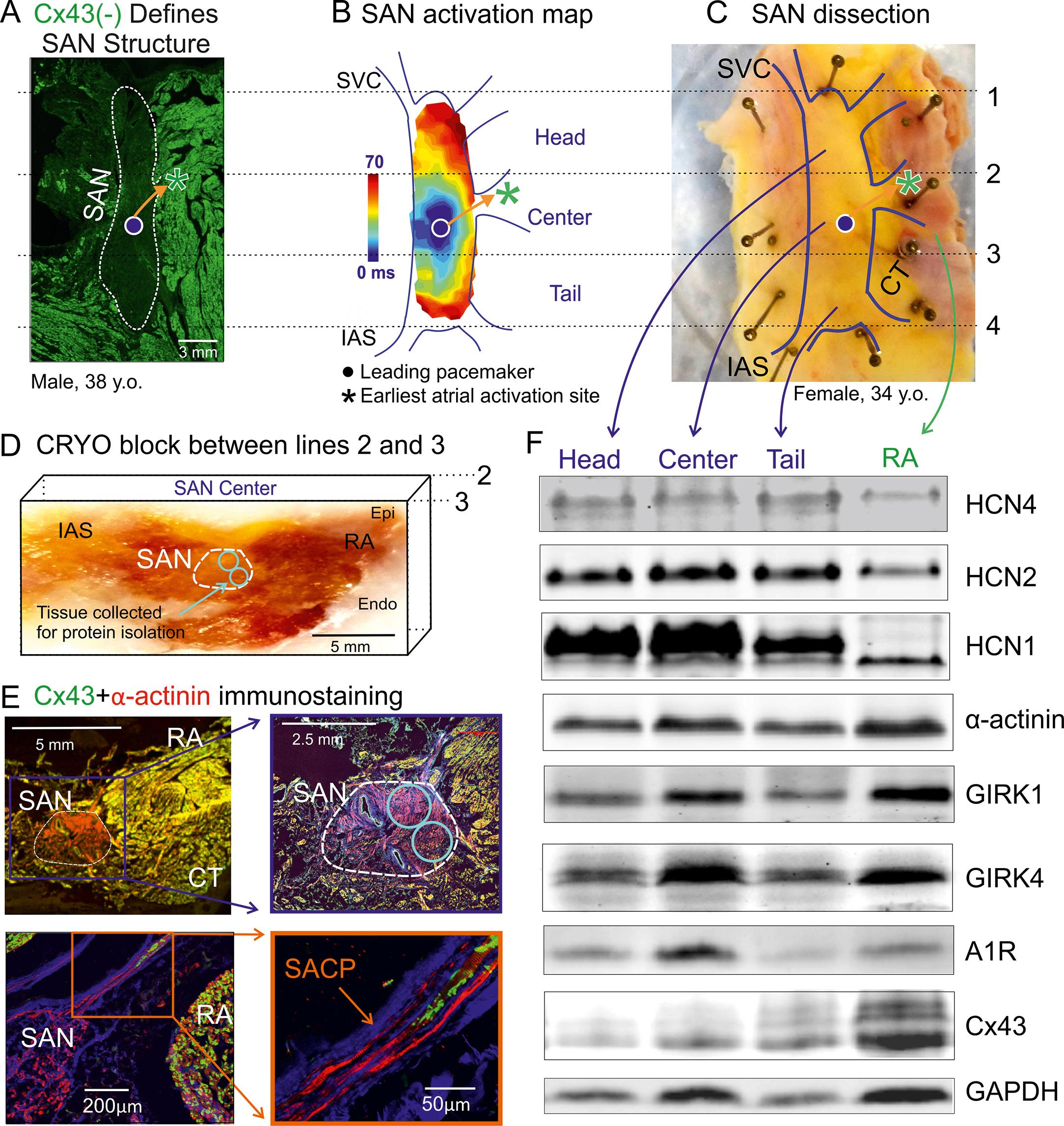 Fig. 28.2, Structural and molecular characteristics of the human sinoatrial node (SAN) pacemaker complex.