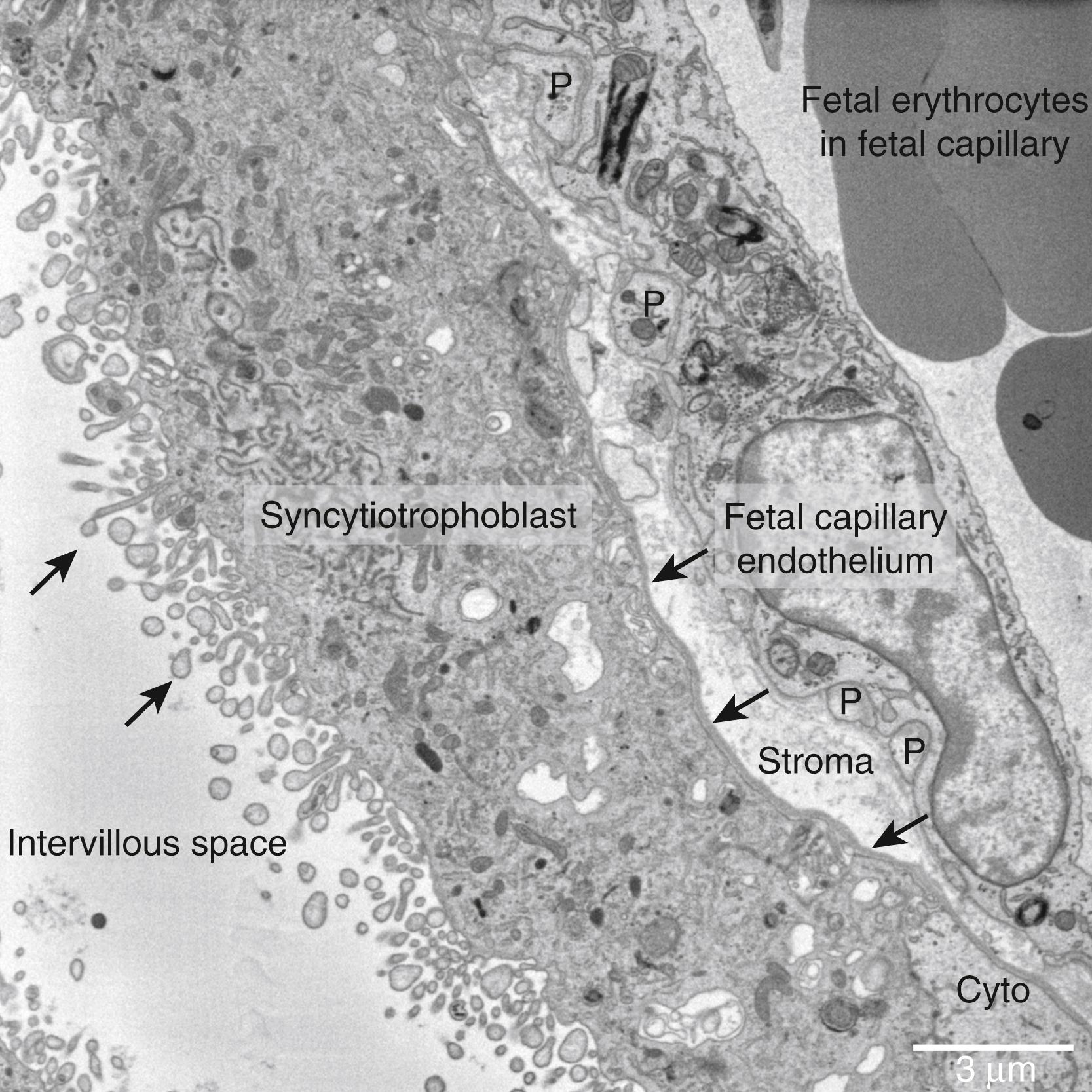 Fig. 10.1, Electron microscopy image showing a cross-section of the human placental barrier at term. The intervillous space is filled with maternal blood, the syncytiotrophoblast forms a continuous barrier across the surface of the villi, the micro villi on the apical plasma membrane are indicated by white arrows , and the syncytiotrophoblast basal membrane can be seen abutting the trophoblast basal lamina, which is indicated by black arrows . A small region of cytotrophoblast can be seen labeled “cyto” between the syncytiotrophoblast and trophoblast basal lamina. The connective tissue of the villous stroma lies between the trophoblast and the fetal capillaries. The stoma also contains fibroblasts and macrophages, which are not shown here. Pericyte fingers around the fetal capillary are labeled “P.” The fetal capillary endothelial cells form the fetal blood vessel.