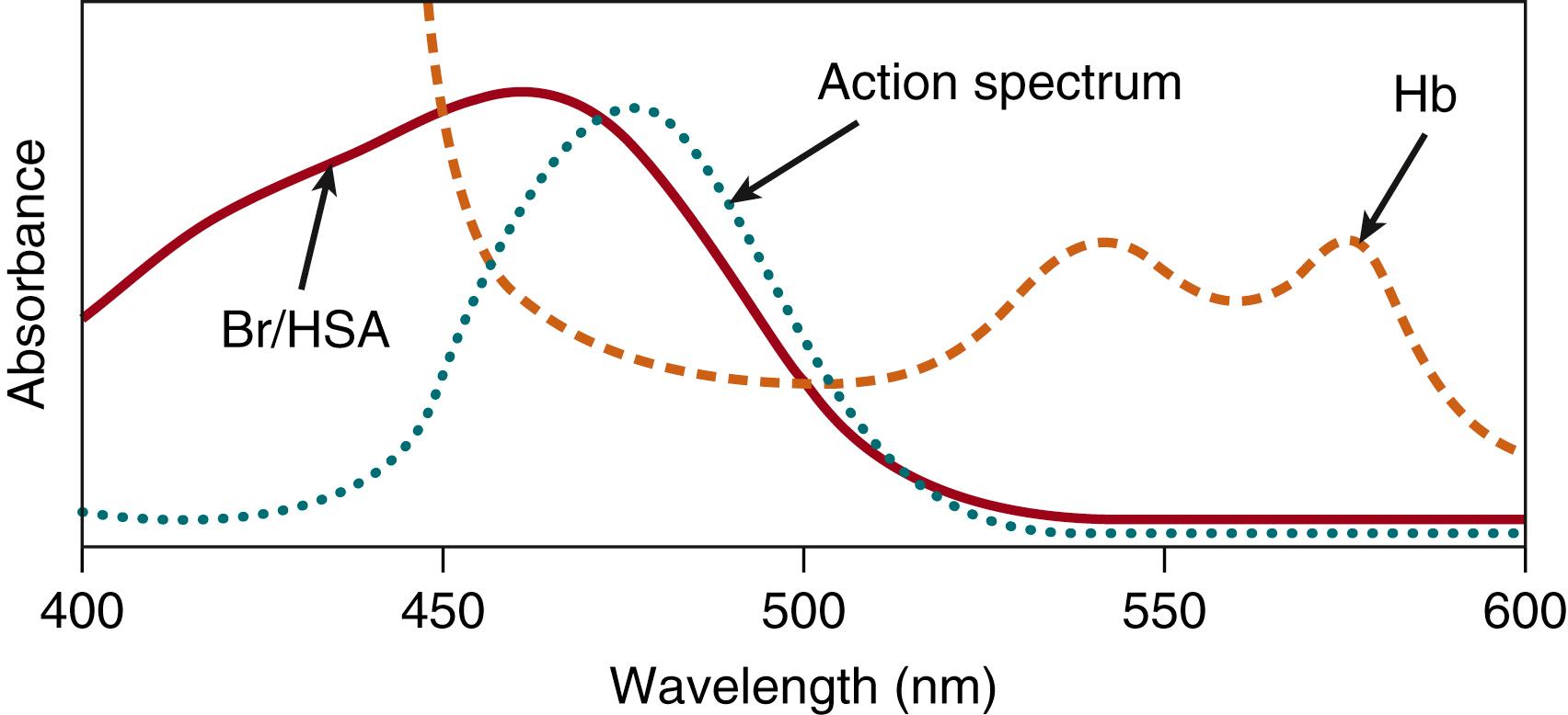 Fig. 92.2, The absorption spectrum of bilirubin: bound to albumin (solid line) and that of hemoglobin (Hb) (at 75% oxygenation, the average between venous and arterial blood in the skin) (dashed line) . The relative magnitudes of the two spectra represent that for total serum/plasma bilirubin at 15 mg/dL and blood Hb at 16.5 g/dL (hematocrit = 50%) except that the bilirubin spectrum is enhanced by a factor of four for easier visualization. It is easily seen that the Hb can effectively compete with bilirubin for light absorption. The dotted line is the relative fraction of light absorbed by the bilirubin and, as such, represents the first order action spectrum (relative efficacy as a function of wavelength ) for bilirubin photochemistry in the blood. Br/HSA , Bilirubin bound to human serum albumin.