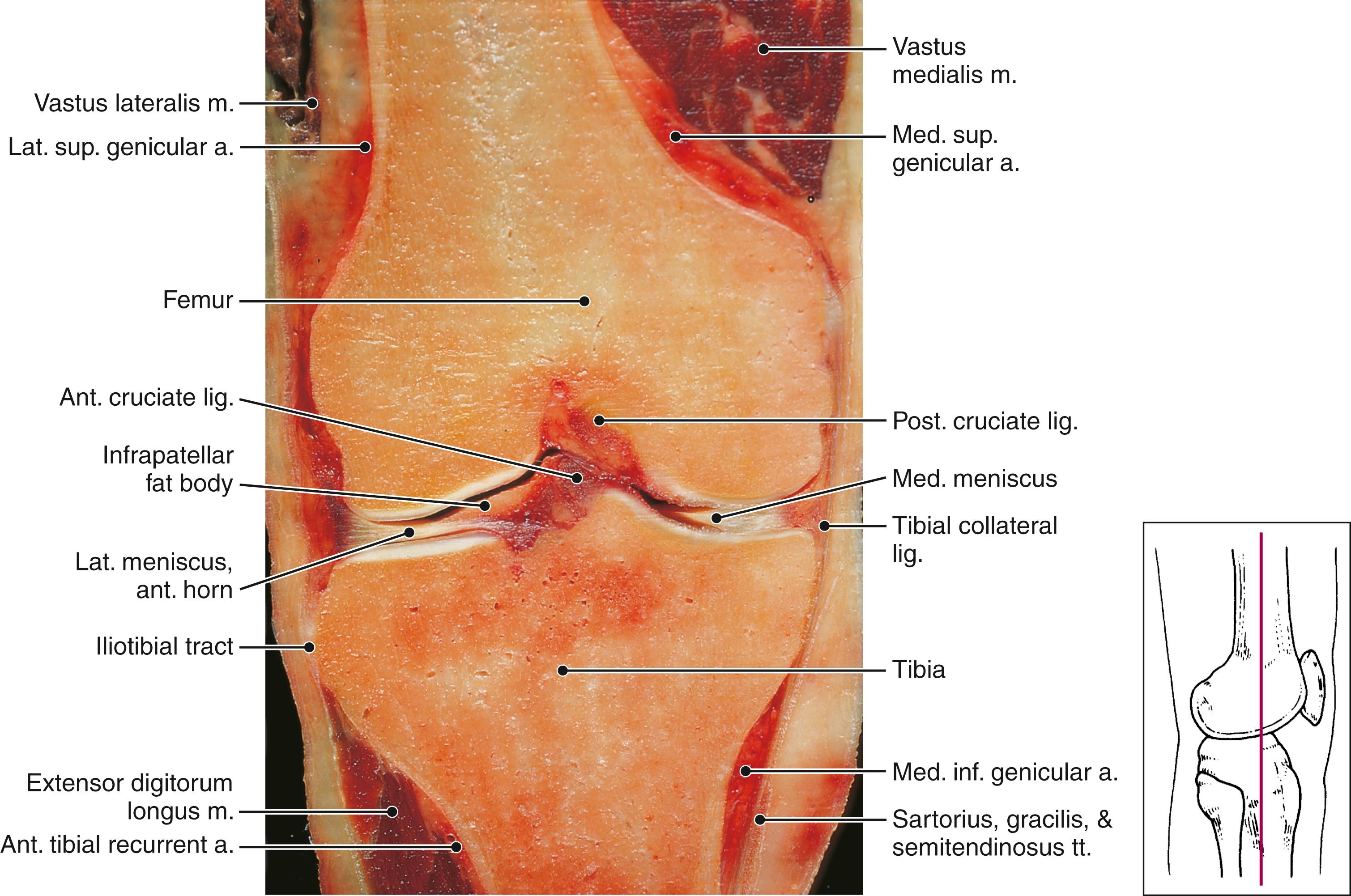 FIG. 163.2, Anatomy of the medial collateral ligament and adjacent structures. a., Artery; ant., anterior; inf., inferior; lat., lateral; lig., ligament; m., muscle; med., medial; post., posterior; sup., superior, tt., tendons.