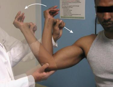 Fig. 26A.3, Moving valgus stress test. The examiner flexes and extends the elbow while applying a valgus force. Reproducible pain at the medial ulnar collateral ligament (MUCL) in the arc between 80 and 120 degrees indicates MUCL injury.