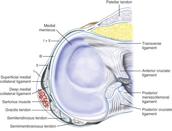 FIG 1-1, Medial layers of the knee. The gracilis and semitendinosus lie between layers 1 and 2.