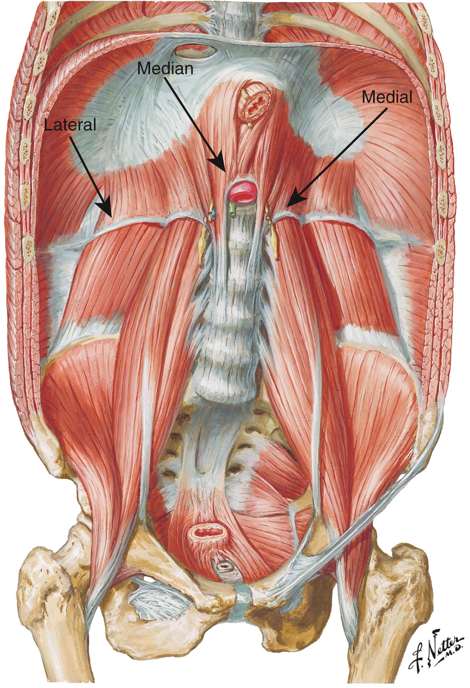 Figure 136.1, Artistic rendering of the retroperitoneal musculature and diaphragm. Arrows depicting the median, medial, and lateral arcuate ligaments.