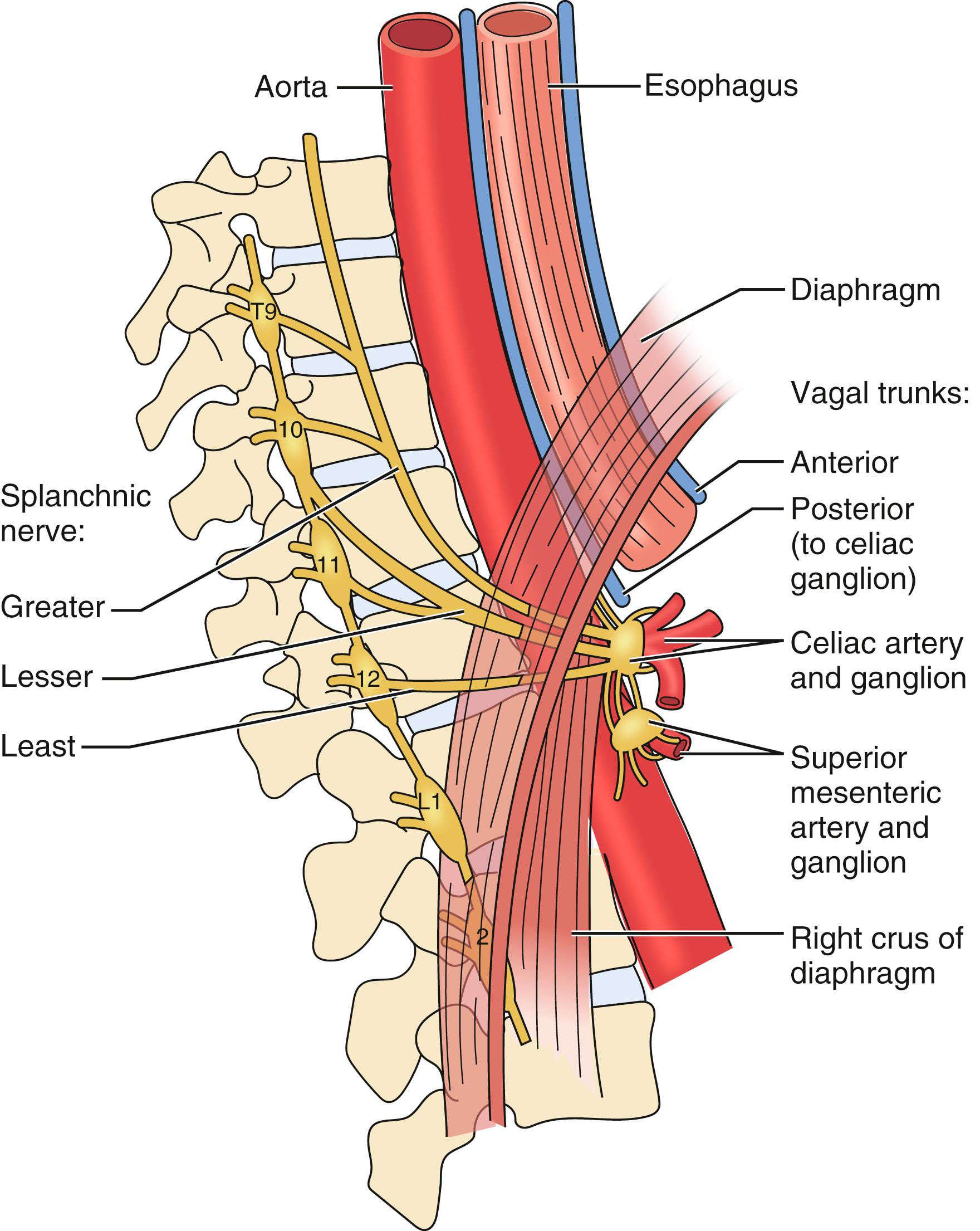 Figure 136.3, Artistic rendering of a sagittal view of the median arcuate ligament and proposed neural networks entering and exiting the celiac ganglion and plexus. Compression of the celiac axis by the median arcuate ligament simultaneously can cause compression of the celiac ganglion.