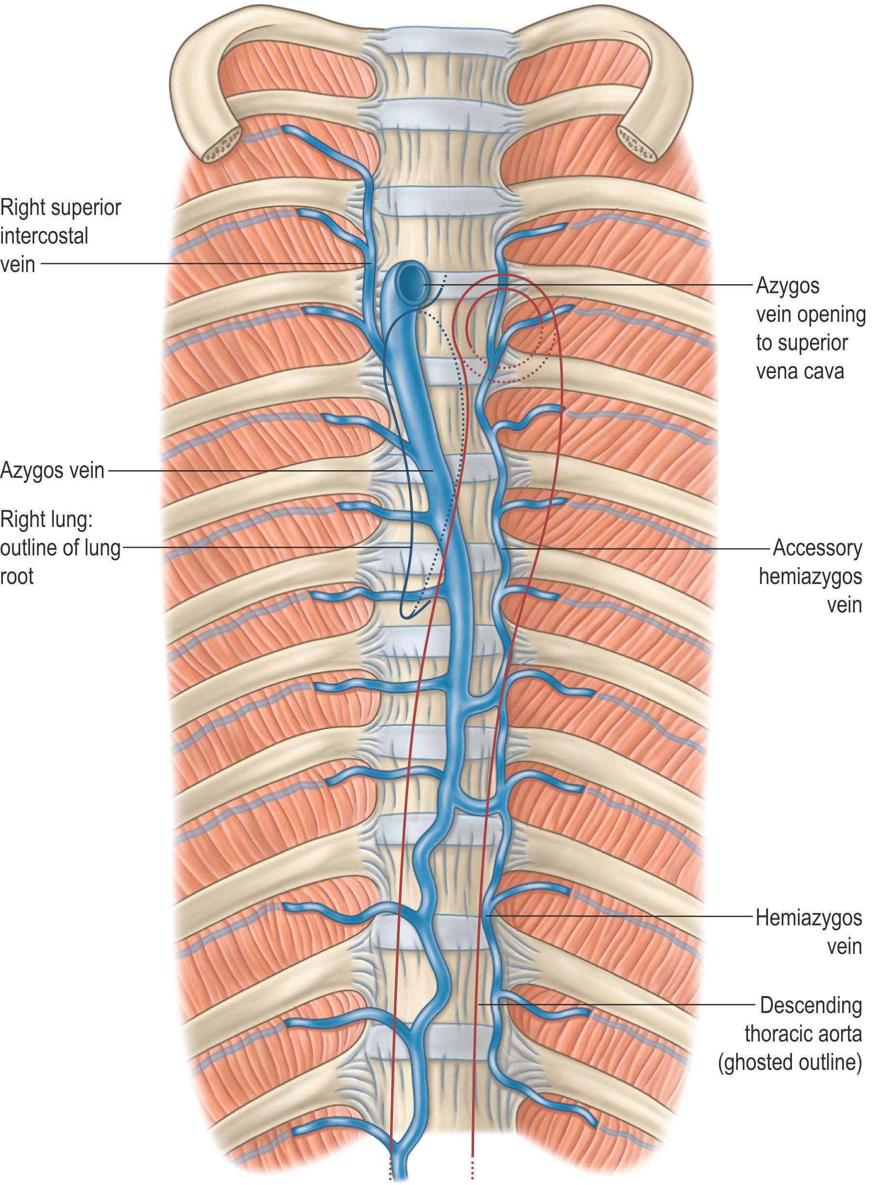 Fig. 56.2, A typical arrangement of the intrathoracic azygos, hemiazygos and accessory hemiazygos veins. Outlines of the root of the right lung and descending thoracic aorta are included for positional reference.