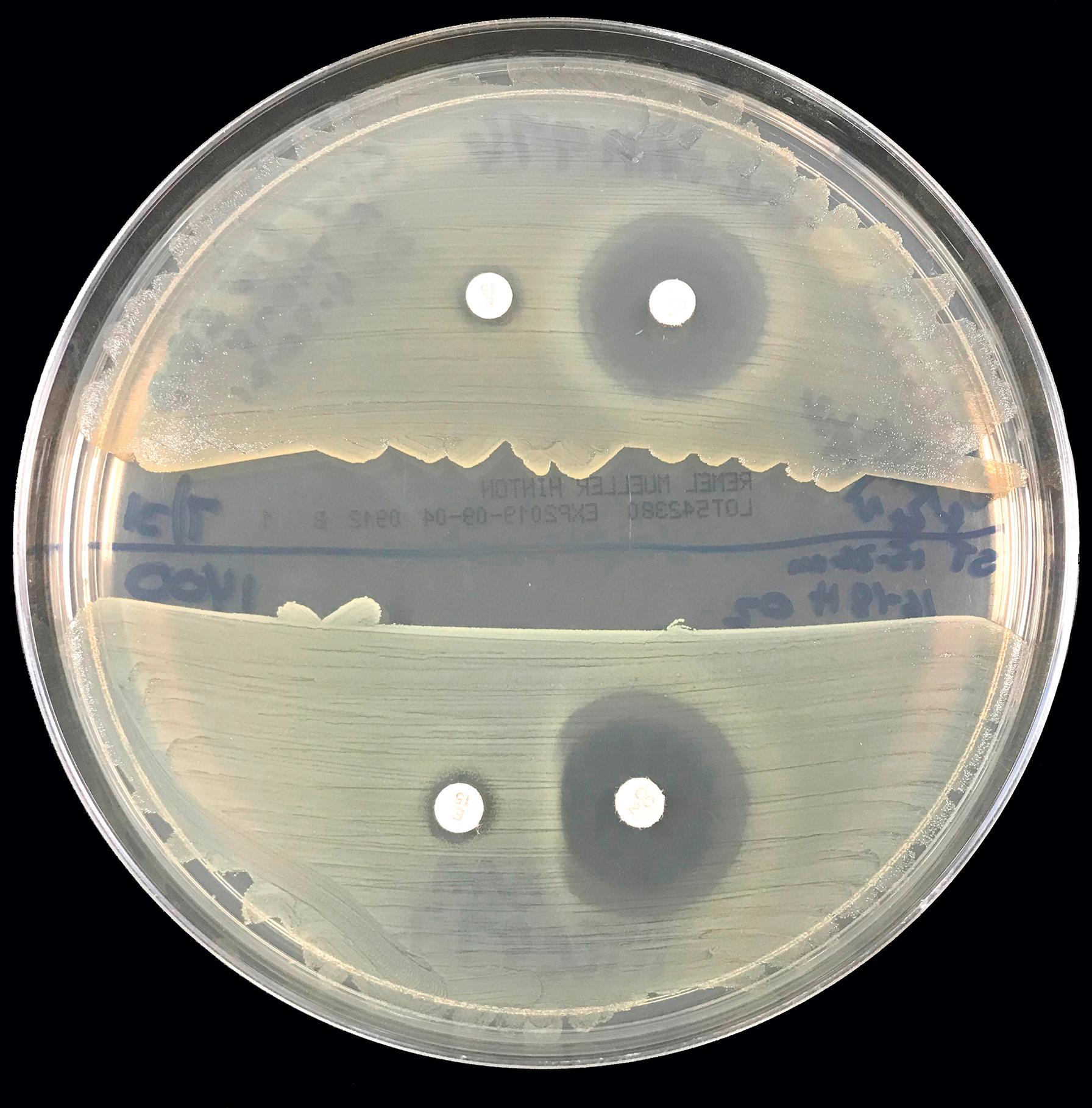 Figure 57.3, Positive D-zone test demonstrating inducible clindamycin resistance.