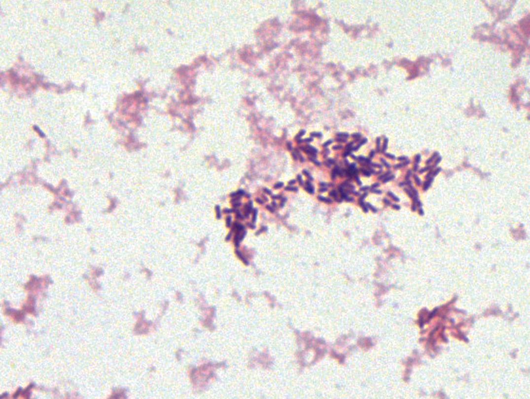 Figure 57.8, Gram stain of a cerebrospinal fluid sample that grew Listeria monocytogenes . The gram-positive rods are short and straight-sided (oil immersion).