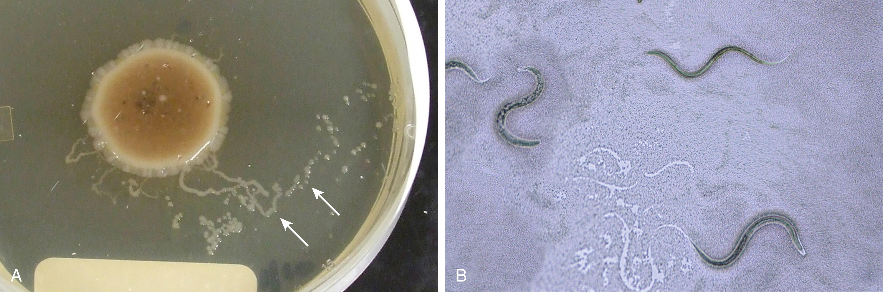 Figure 65.3, A, Stool agar culture method showing bacterial tracks (arrows) formed by migrating Strongyloides stercoralis larvae. B, Examination of the plate using a light microscope reveals multiple larvae and detail of the agar tracks (unstained, 100×).