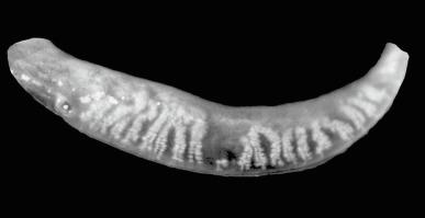 Fig. 7.7, Enhanced meibography image, captured with the LipiScan Dynamic Meibomian Imager, showing fine detail of meibomian glands in the everted lower lid. Gland drop-out is evident in the middle of the lid.