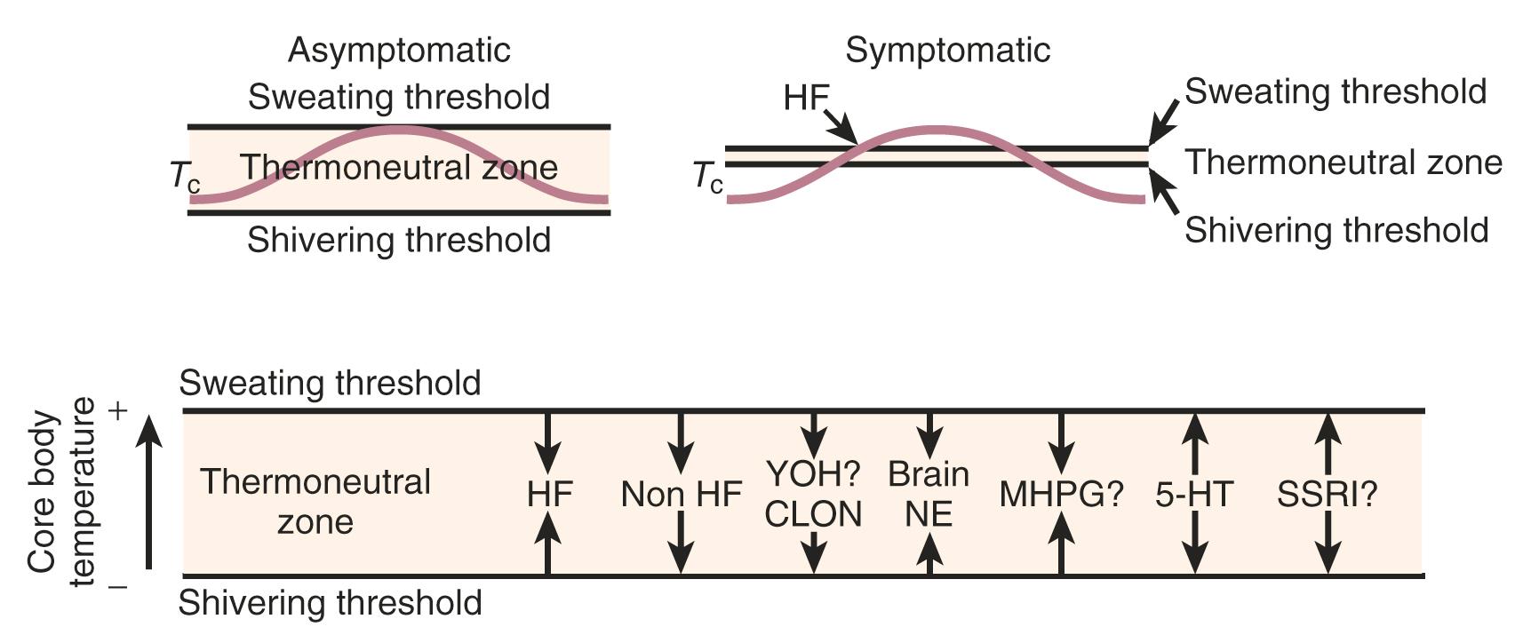 Fig. 14.18, Narrowing of the thermoregulatory zone in symptomatic women.