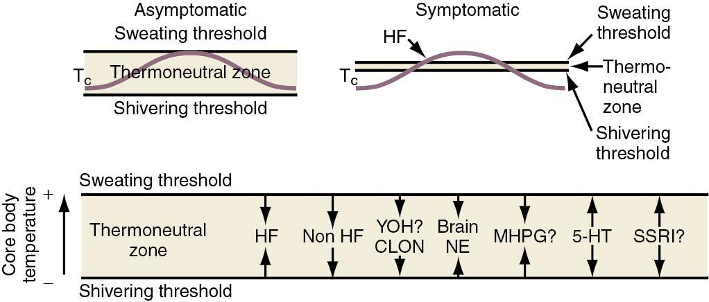 Fig. 14.17, Narrowing of the thermoregulatory zone in symptomatic women. 5-HT, 5-Hydroxytryptamine; HF, Hot flush; SSRI, selective serotonin reuptake inhibitor.