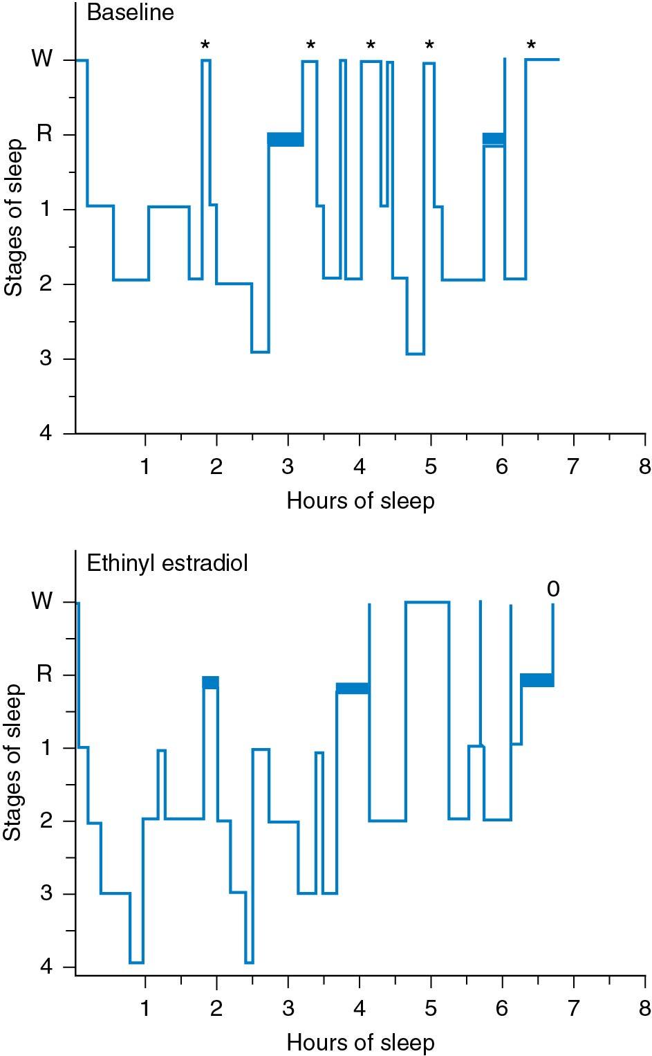 Fig. 14.20, Sleep grams measured in a symptomatic patient before and after a 30-day administration of ethinyl estradiol, 50 μg four times daily.