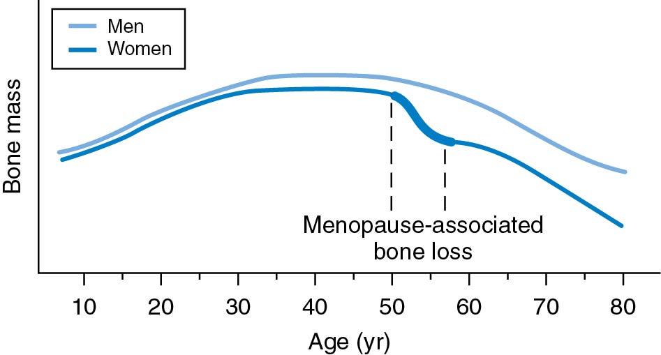 Fig. 14.21, Bone mass by age and sex.