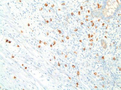 Figure 16.15, KIT Immunoreactivity in Mast Cells.