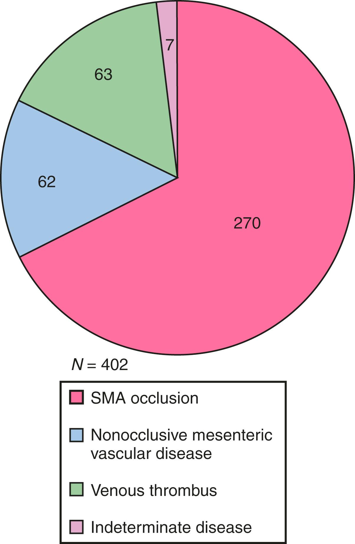 Figure 137.1, Acute mesenteric ischemia: distribution of etiologies in 402 patients in Malmö, Sweden, between 1970 and 1982. 4 , 5 Mesenteric venous thrombosis, acute SMA occlusion (embolus/thrombus ratio = 1.4), and nonocclusive mesenteric ischemia were found in 16%, 68%, and 16%, respectively. SMA , superior mesenteric artery.