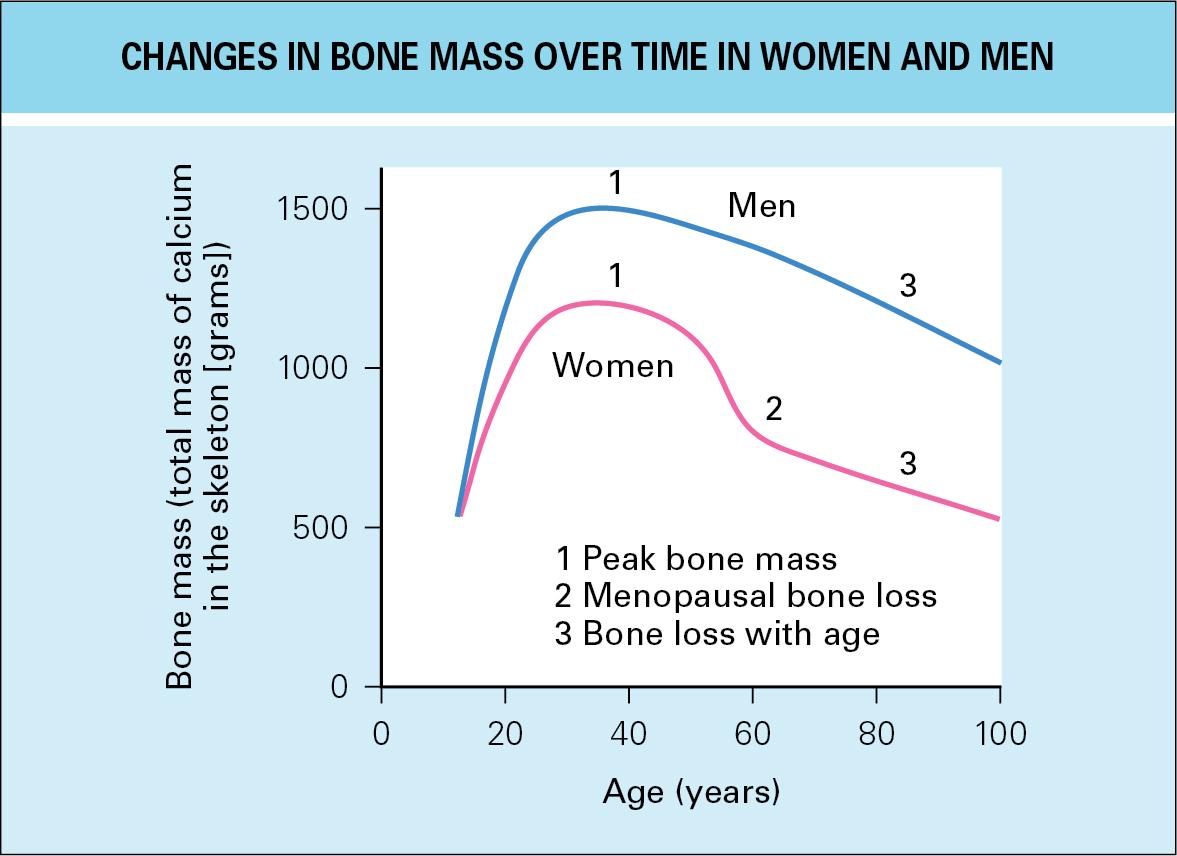 Fig. 64.4, Changes in bone mass over time in men and women.