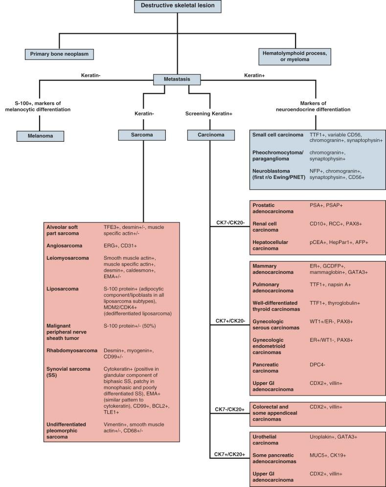 FIGURE 19-10, Algorithm for the immunohistochemical evaluation of a metastasis of unknown primary.