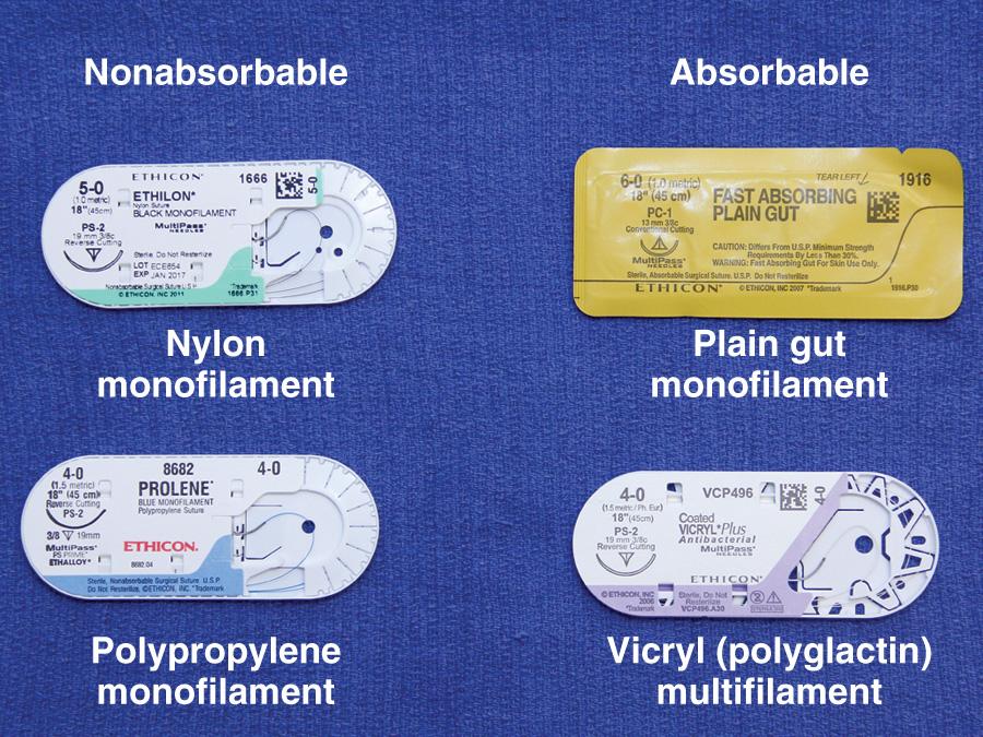 Figure 35.12, A wide variety of both absorbable and nonabsorbable suture material is available. Other variables include suture size (e.g., 4-0, 5-0, 6-0), needle size, and type (e.g., PS-2, reverse cutting, conventional cutting). These variables are discussed in detail in the text.