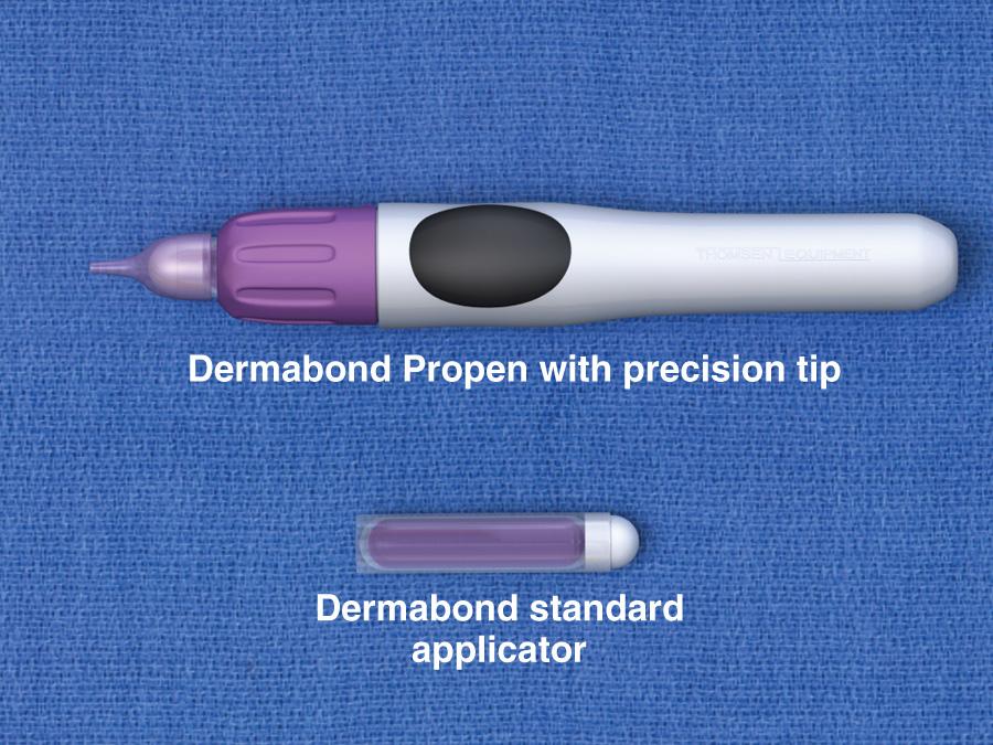 Figure 35.6, Tissue adhesive, 2-octylcyanoacrylate, comes in a variety of commercially available dispensers.