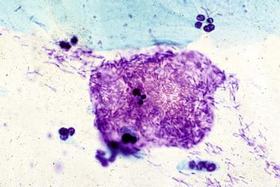 Figure 7-14, Organisms sticking to squamous cell. Cervicovaginal smear (Papanicolaou, ×MP).