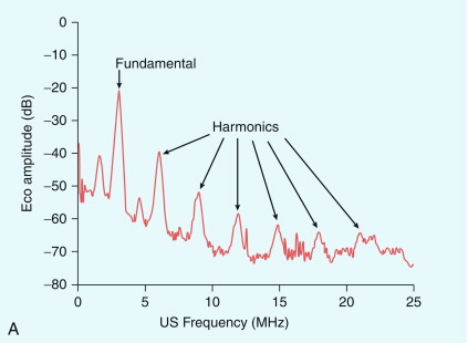 FIGURE 17-2, (A) Harmonic emission from microbubbles. Microbubbles are insonated at 3 MHz and the echo analysed for its frequency content. The largest peak of the energy in the echo is at the 3 MHz fundamental, but that there are clear secondary peaks in the spectrum at 6, 9, 12, 15 and 18 MHz, as well as peaks between these harmonics (‘ultra-harmonics’) and below the fundamental (the ‘sub-harmonic’). Harmonic imaging and Doppler aim to separate and process the second harmonic echo only, which is about 18 dB less than that of the fundamental echo signal. (B) Principle of Pulse Inversion Imaging. A pulse of sound (a) is transmitted into the body and echoes are received from agent and tissue. A second pulse (b), which is an inverted copy of the first, is then transmitted in the same direction and the two resulting echoes summed. Linear echoes from tissue are inverted copies of each other and cancel to zero (c, middle). Microbubble echoes are distorted copies of each other, so that the even nonlinear components of these echoes reinforce each other when summed, producing a strong harmonic signal (c, right side).