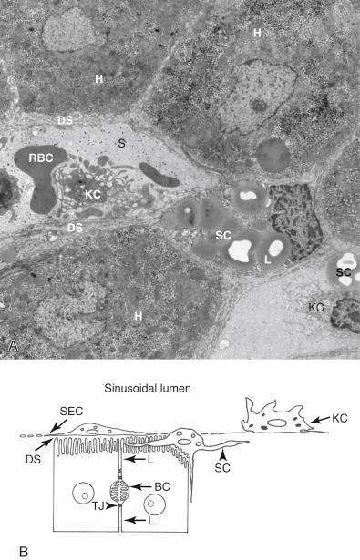 Figure 1.11, A, Disse space ( DS ) is not visible on an H&E stain but can be seen on electron microscopy as a narrow space lying between sinusoids ( S ) on one side and hepatocytes ( H ) on the other. It contains microvilli arising from the sinusoidal domain of the hepatocellular membrane. Stellate cells ( SC ) reside in the DS, whereas Kupffer cells ( KC ) lie in sinusoids, in which red blood cells ( RBC ) can also be seen. KC possess highly ruffled membranes. Stellate cells store lipids ( L ). B, Schematic representation of hepatic microarchitecture. The hepatocyte is a polarized cell whose sinusoidal domain contains microvilli and faces the DS. The canalicular domain forms the bile canaliculus ( BC ), whereas the lateral domain ( L ) lies between the sinusoidal and canalicular domains. The bile canaliculus is sealed by tight junctions ( TJ ) to prevent efflux of bile. The sinusoids are lined by fenestrated endothelial cells ( SEC ); the size of the fenestrations regulates passage of macromolecules from the blood into the Disse space. Stellate cells ( SC ) lie in the DS and KC in the sinusoids.