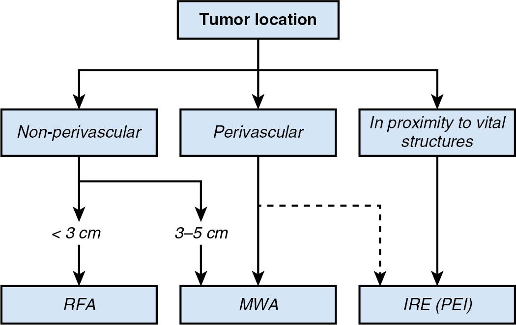 FIGURE 96C.1, Proposed algorithm for the use of the different techniques of image-guided ablation in the treatment of malignant liver tumors. The algorithm assumes a successful completion of the described clinical validation process and takes into account tumor size and location as the main drivers for the choice of the ablation technique. RFA is supposed to remain an accepted option for small (3 cm or less) tumors in nonperivascular locations. MWA is expected to become the preferred modality for ablation of tumors of intermediate size (3–5 cm) or in perivascular locations. Tumors in proximity to vital structures (including vessels) are directed toward nonthermal techniques such as IRE or percutaneous ethanol injection (PEI). The use of PEI is only recommended for small HCC tumors. IRE, Irreversible electroporation; MWA, microwave ablation; PEI, percutaneous ethanol injection; RFA, radiofrequency ablation.