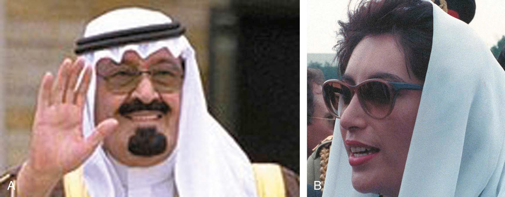 Figure 31-2, Nasal features in some of the well-known Middle Eastern political figures, exemplifying typical visual attributes of a Middle Eastern nose. A, Prince Abdullah of Saudi Arabia. (This image is from Wikimedia and is a work of an employee of the Executive Office of the President of the United States, taken or made during the course of the person’s official duties. As a work of the U. S. federal government, the image is in the public domain. http://commons.wikimedia.org/wiki/File:Saudi_Crown_Prince_Abdullah_and_George_W._Bush.jpg ). B, Benazir Bhutto. (This image is from Wikimedia and is courtesy of SRA Gerald B. Johnson, United States Department of Defense. This image is a work of a U. S. military or Department of Defense employee, taken or made during the course of an employee’s official duties. As a work of the U. S. federal government, the image is in the public domain. http://commons.wikimedia.org/wiki/File:Benazir_bhutto_1988_cropped.jpg ).