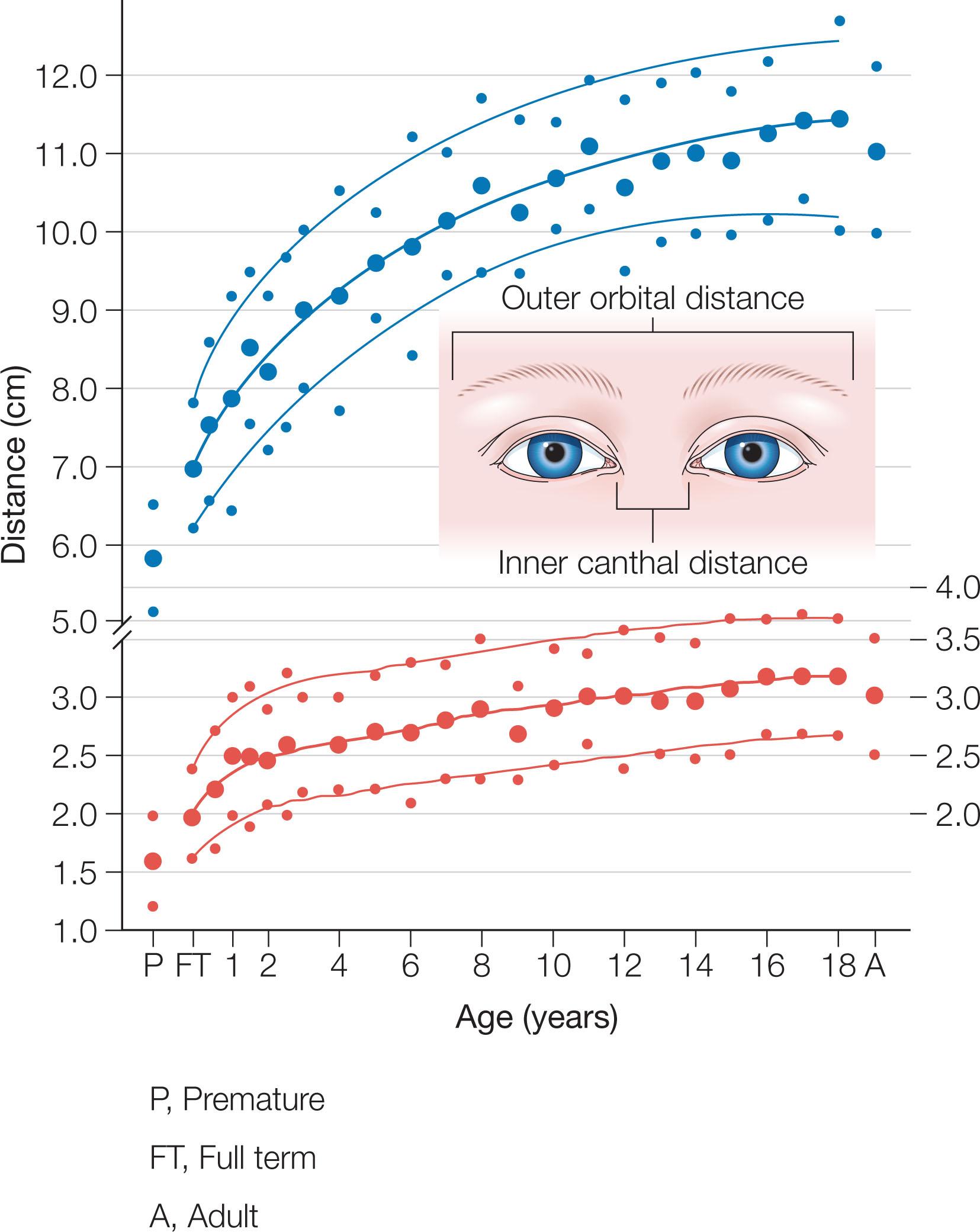 Fig. 4.5, Graphs of inner canthal and outer orbital distances. The large points represent the mean value for each age group, the smaller points represent 2 SD from the mean. The heavy line approximates the 50th percentile, while the shaded area roughly encompasses the range from the 3rd to the 97th percentile.