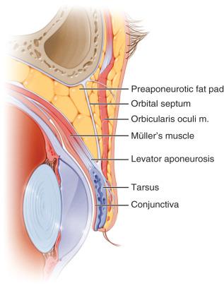Figure 10.4, The important anatomic structures of the upper eyelid. m. , Muscle.