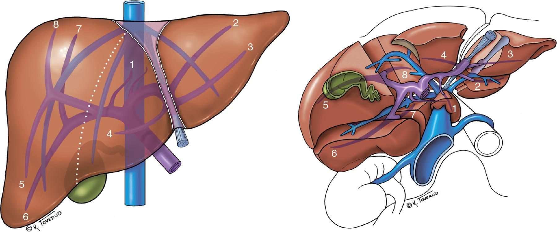 FIGURE 127D.1, Liver anatomy and the laparoscopic view of the liver segments.