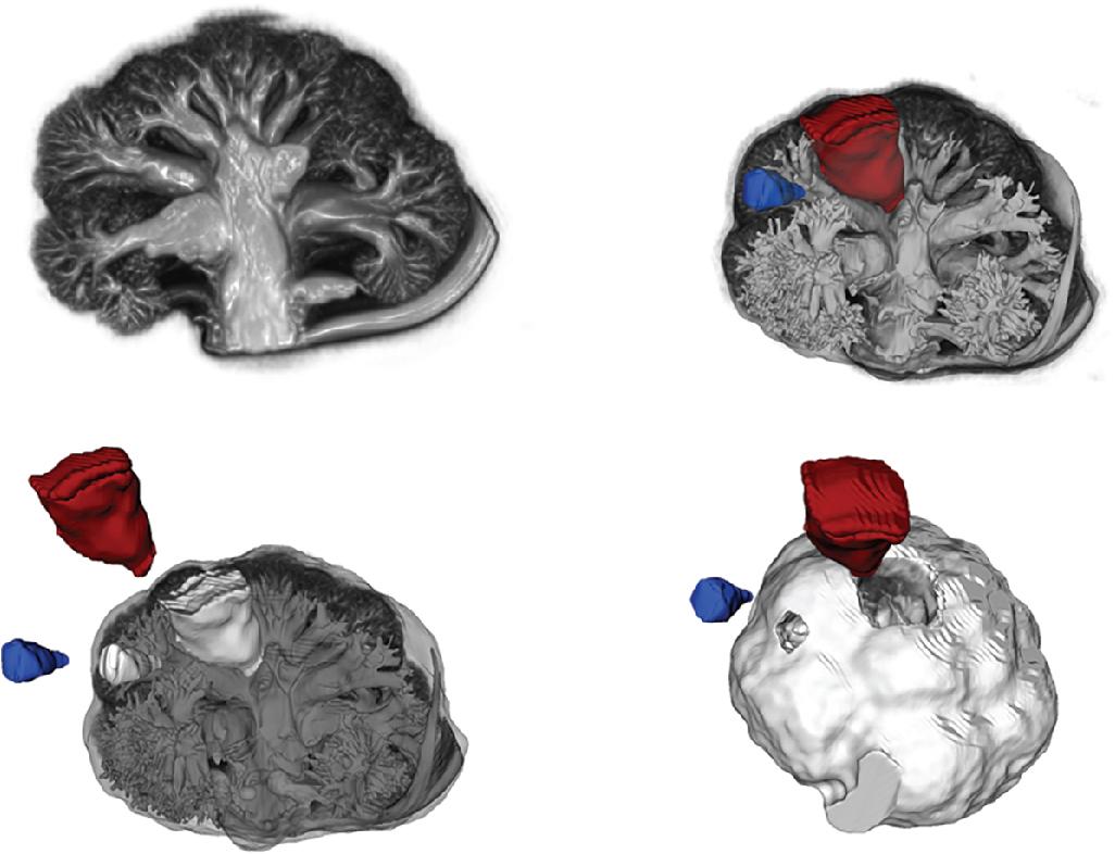 FIGURE 127D.5, Cauliflower segments.