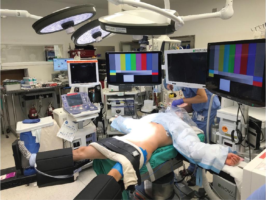 FIGURE 128.1, The operating room setup.