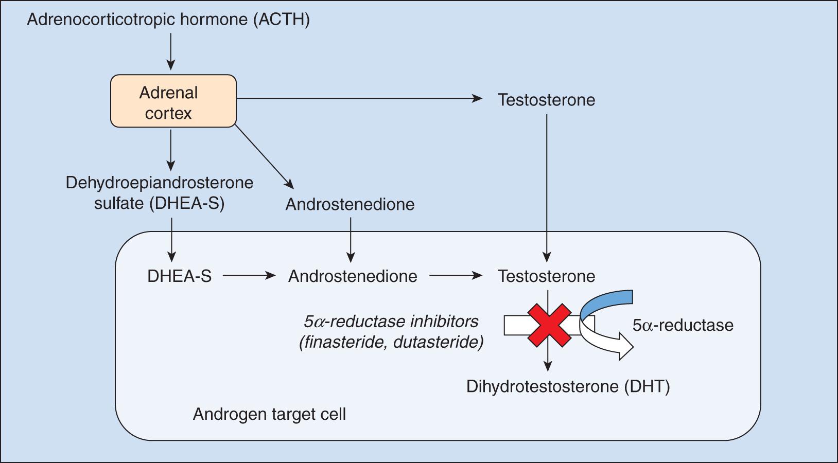 Fig. 8.1, The enzyme 5α-reductase converts testosterone to the more potent dihydrotestosterone (DHT), inducing characteristic miniaturization of the hair follicles in androgenetic alopecia (AGA). Inhibition of this pathway is the target of the 5α-reductase inhibitors finasteride and dutasteride.