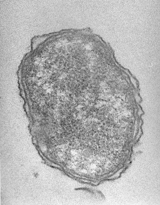 FIG. 295.2, A transmission electron micrograph of an extracellular Orientia tsutsugamushi rickettsial microorganism, the causative agent of scrub typhus or tsutsugamushi disease throughout Southeast Asia and the Western Pacific region.