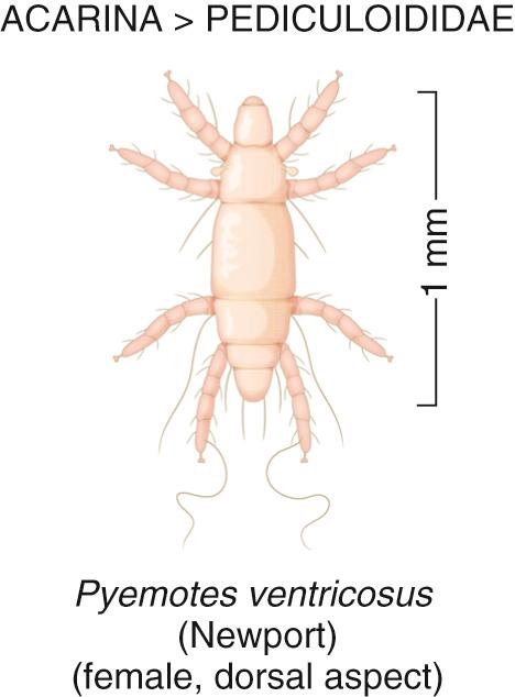 FIG. 295.4, An illustration of the dorsal aspect of the female grain (hay) itch mite, Pyemotes tritici ventricosus (formerly Pyemotes ventricosus ), which is a common cause of highly pruritic and papulovesicular rashes among hay threshers, hay wagon riders, outdoor yard workers, and campers during late summers worldwide.