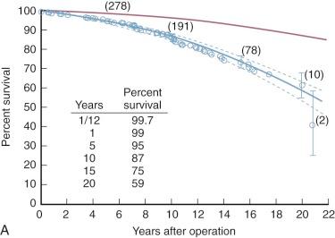 Figure 11-21, Survival after mitral commissurotomy by either closed or open technique. A, Survival. Each circle represents a death, positioned according to Kaplan-Meier estimator, vertical bars represent 70% confidence limits (CL), and numbers in parentheses are patients at risk. Blue line enclosed within dashed CLs is the parametric survival estimate. Red curve is survival of an age/gender/ethnicity–matched general population. B, Hazard function for death. Note steadily rising single hazard phase. Dashed lines are CLs. Red line is hazard for an age-gender-ethnicity–matched general population.