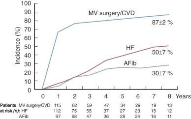Figure 11-5, Cumulative incidence of atrial fibrillation (AFib), heart failure (HF), or mitral valve (MV) surgery/cardiovascular death (CVD) during nonsurgical management of patients ( n = 394) with mitral regurgitation due to flail leaflet.