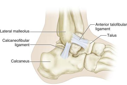 FIG. 64.4