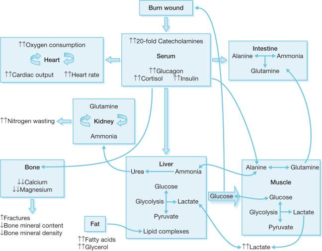 Fig. 29.1, The effects of metabolic dysfunction after severe burn injury.