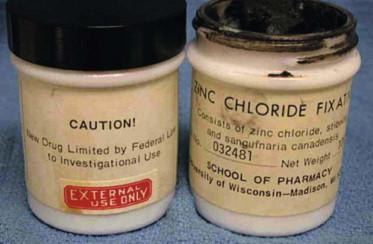 FIGURE 45.1, On the right, the zinc chloride fixative originally used by Dr Mohs in chemosurgery. Note its dark color. A similar bloodroot extract currently commercially available from homeopathic sources for patient self-application (“black salve”) is not recommended because of the inherent risks in self-application in an unsupervised setting.