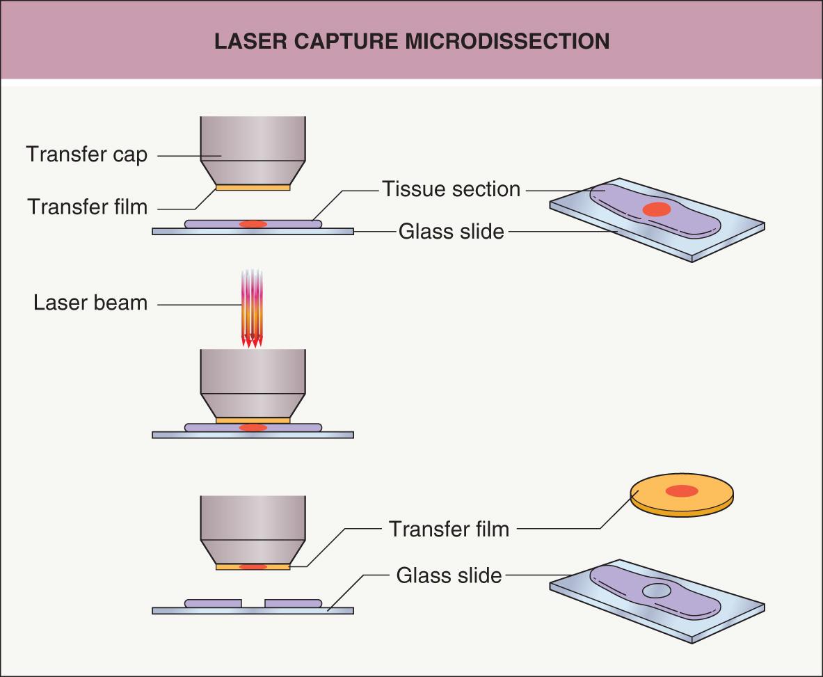 Fig. 3.2, Laser capture microdissection.