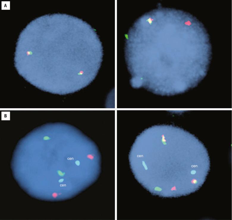 FIG. 24.2, Detection of MYC gene rearrangements.